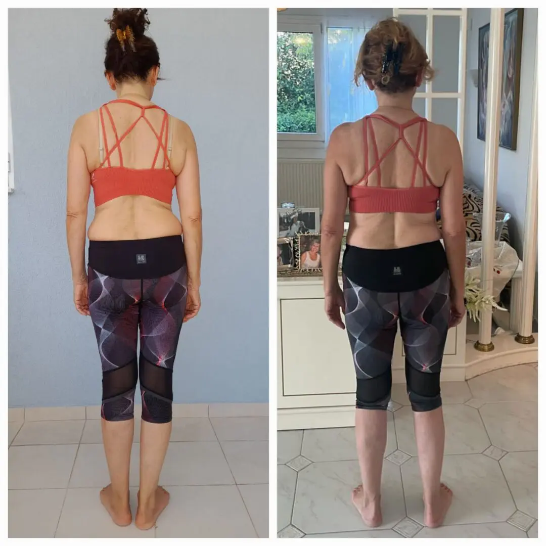 "Relief from chronic lower back and hip pain after 15 years, thanks to strengthening and correcting posture using the Functional Patterns method."