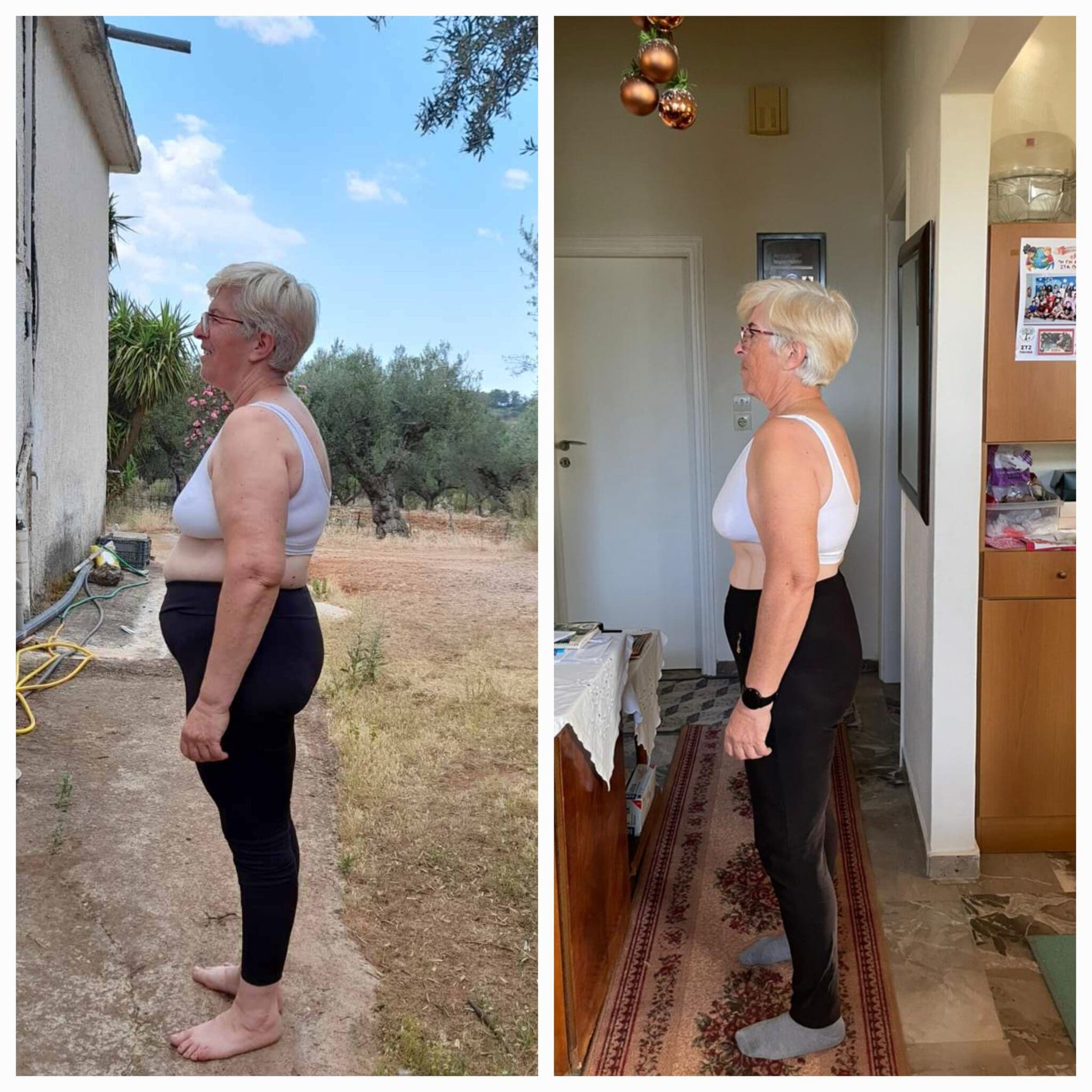 Living pain-free in the lower back and improving scoliosis. Results in posture and chronic pain relief after 10 months of reducing grains from the diet.